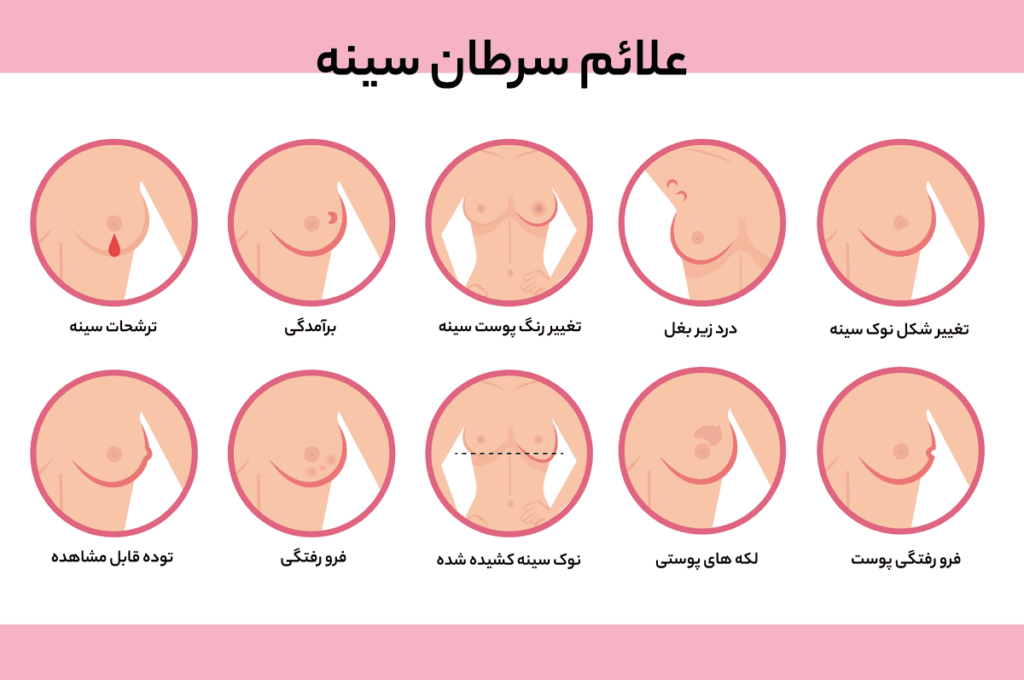 علائم سرطان سینه